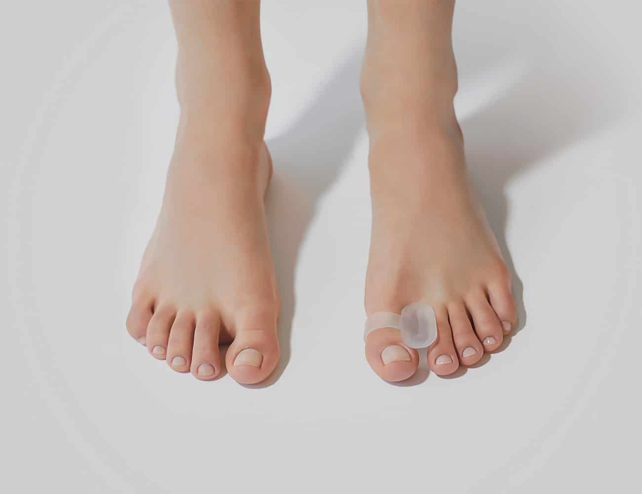 toe ring separator